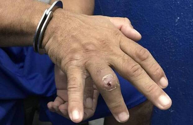 Técnica de tortura de quebrar dedo de presos é detectada em cinco estados